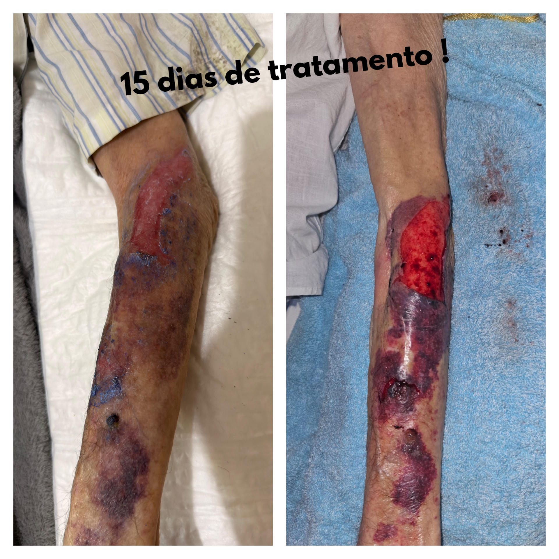 Registro comparativo da evolução de uma lesão durante o tratamento